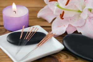accupuncture