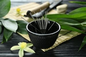 accupuncture